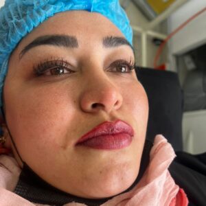 SESION DE LABIOS, MICROBLADING CEJAS, UN PAR DE LINEAS EN PARPADOS