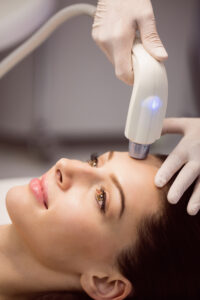 ACNE  IPL